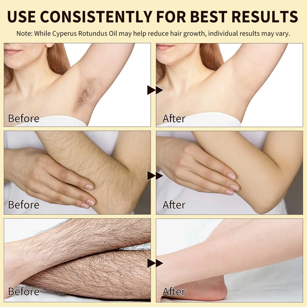 100% Pure Cyperus Rotundus Oil for Hair Removal. Moisturizes, Soothes, Reduces Unwanted Hair. for All Skin Types. 2.02 Fl Oz