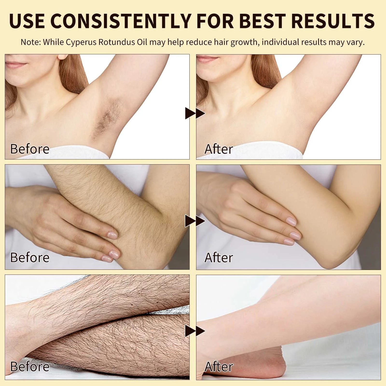 100% Pure Cyperus Rotundus Oil for Hair Removal. Moisturizes, Soothes, Reduces Unwanted Hair. for All Skin Types. 2.02 Fl Oz