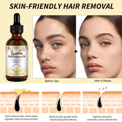 100% Pure Cyperus Rotundus Oil for Hair Removal. Moisturizes, Soothes, Reduces Unwanted Hair. for All Skin Types. 2.02 Fl Oz